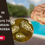 Stay Safe in the Water: Simple Ways to Prevent Brain-Eating Amoeba